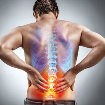 Sciatica Therapy in Carthage, TX